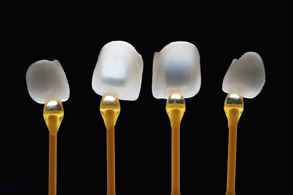 dentiste-collignon-audrey-facettes-ceramiques